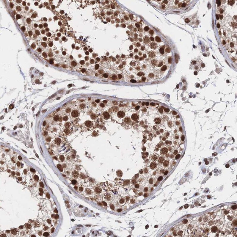WHSC2 Antibody - BSA Free Immunohistochemistry-Paraffin: WHSC2 Antibody [NBP2-38454]