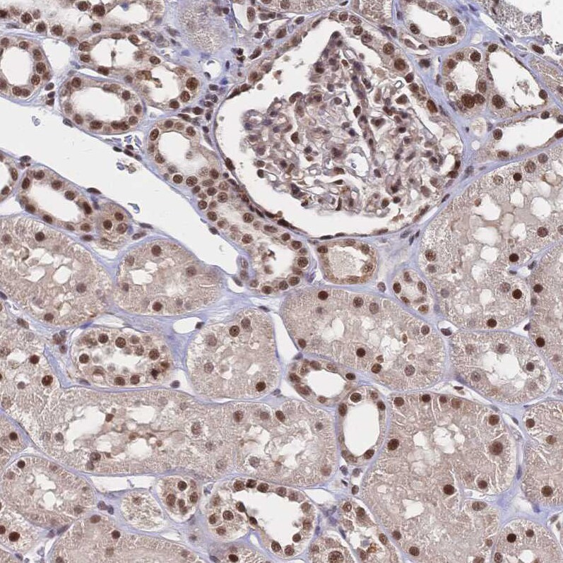 WHSC2 Antibody - BSA Free Immunohistochemistry-Paraffin: WHSC2 Antibody [NBP2-38454]