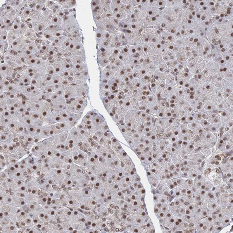 WHSC2 Antibody - BSA Free Immunohistochemistry-Paraffin: WHSC2 Antibody [NBP2-38454]