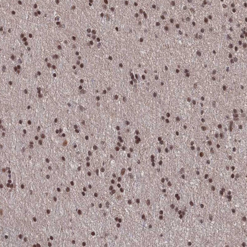 WHSC2 Antibody - BSA Free Immunohistochemistry-Paraffin: WHSC2 Antibody [NBP2-38454]