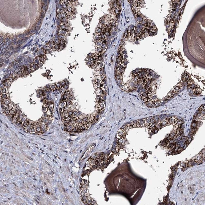 MICALCL Antibody - BSA Free Immunohistochemistry-Paraffin: MICALCL Antibody [NBP2-38455]