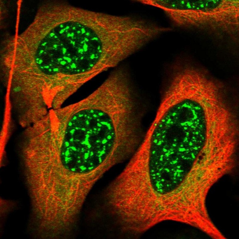 TAB1 Antibody - BSA Free Immunocytochemistry/ Immunofluorescence: TAB1 Antibody [NBP2-38458]