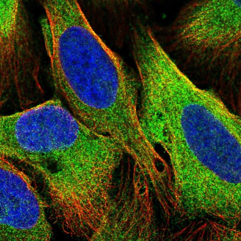 TBC1D4 Antibody - BSA Free Immunocytochemistry/ Immunofluorescence: TBC1D4 Antibody [NBP2-38460]