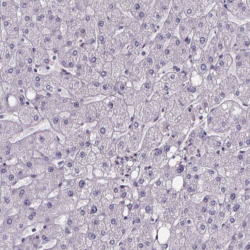 Sperm Flagellar 2 Antibody - BSA Free Immunohistochemistry-Paraffin: Sperm Flagellar 2 Antibody [NBP2-38461]