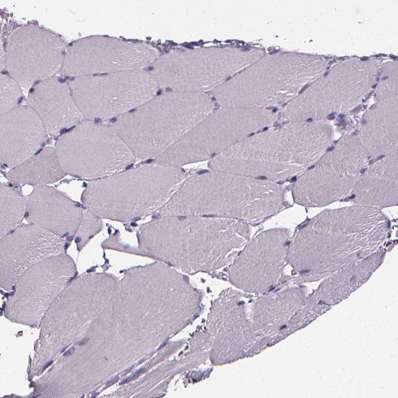 Sperm Flagellar 2 Antibody - BSA Free Immunohistochemistry-Paraffin: Sperm Flagellar 2 Antibody [NBP2-38461]