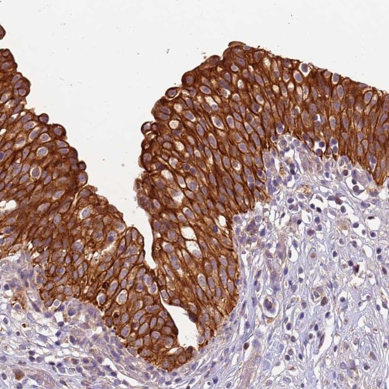 TIGAR/C12orf5 Antibody - BSA Free Immunohistochemistry-Paraffin: TIGAR/C12orf5 Antibody [NBP2-38462]