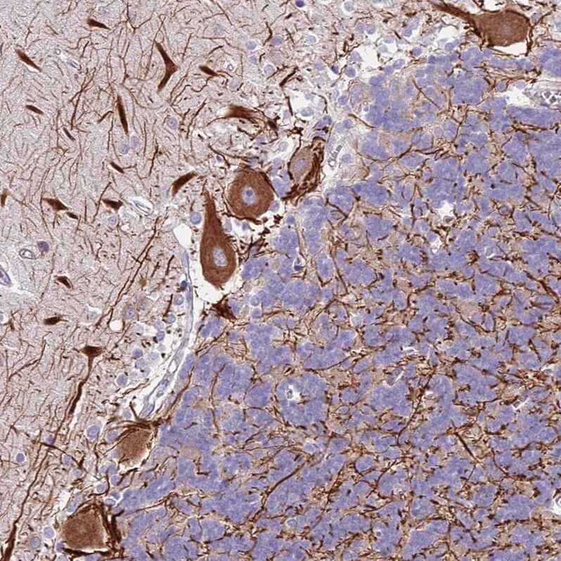 C2CD3 Antibody - BSA Free Immunohistochemistry: C2CD3 Antibody - BSA Free [NBP2-38466]