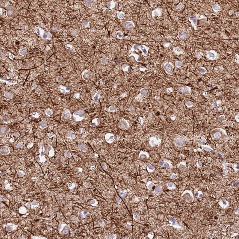 C2CD3 Antibody - BSA Free Immunohistochemistry: C2CD3 Antibody - BSA Free [NBP2-38466]