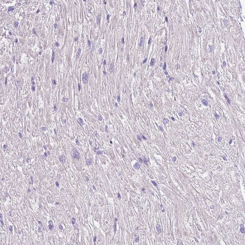 C2CD3 Antibody - BSA Free Immunohistochemistry: C2CD3 Antibody - BSA Free [NBP2-38466]