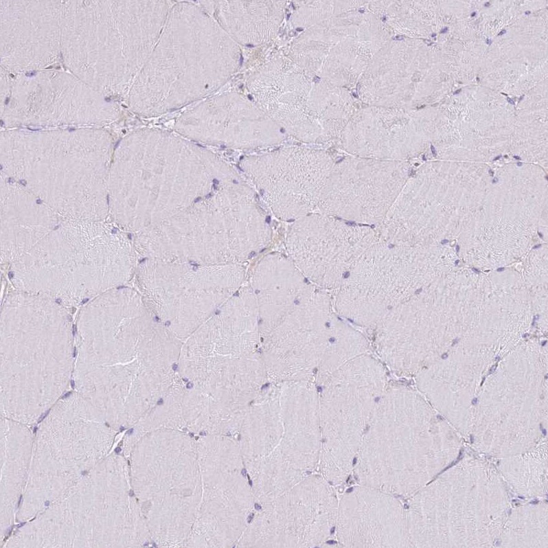 C2CD3 Antibody - BSA Free Immunohistochemistry: C2CD3 Antibody - BSA Free [NBP2-38466]
