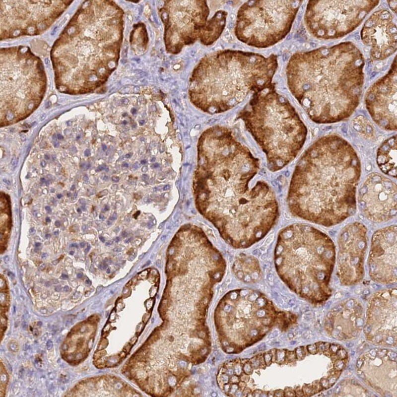 CD-M6PR Antibody - BSA Free Immunohistochemistry: CD-M6PR Antibody - BSA Free [NBP2-38467]