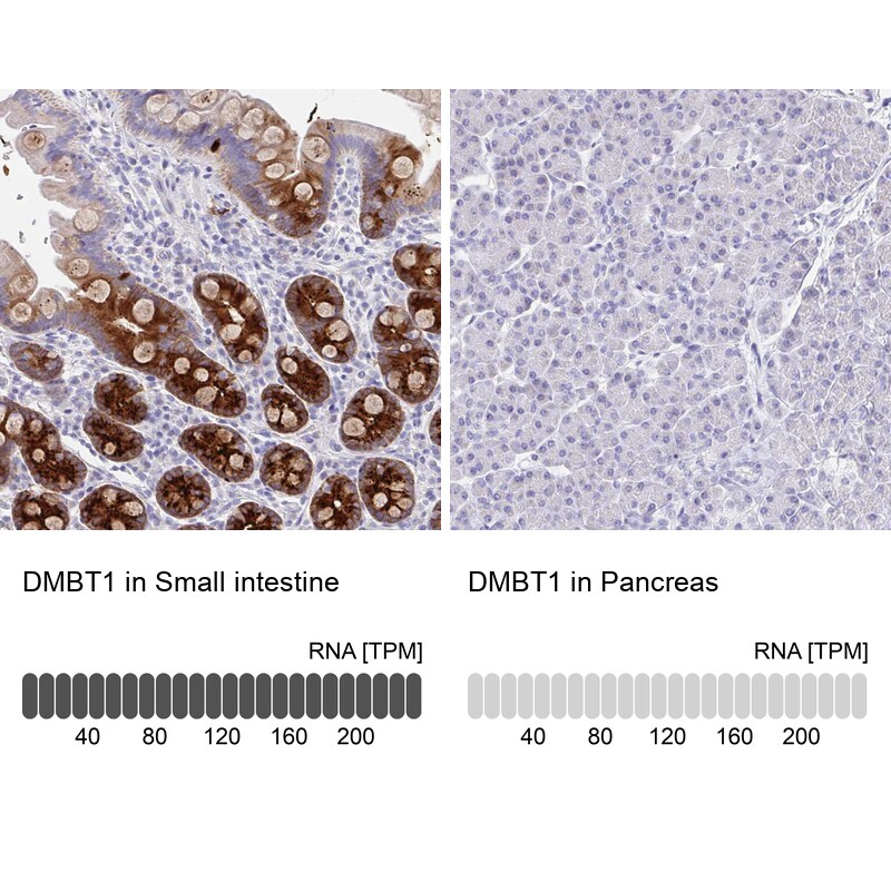 DMBT1/GP340 Antibody - BSA Free Immunohistochemistry-Paraffin: DMBT1/GP340 Antibody [NBP2-38471]
