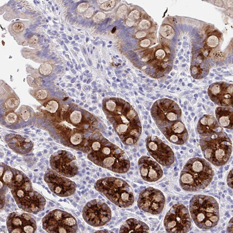DMBT1/GP340 Antibody - BSA Free Immunohistochemistry-Paraffin: DMBT1/GP340 Antibody [NBP2-38471]