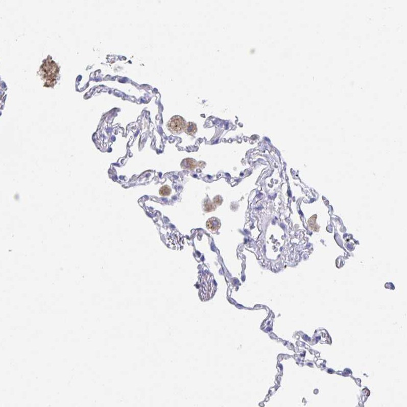 DMBT1/GP340 Antibody - BSA Free Immunohistochemistry-Paraffin: DMBT1/GP340 Antibody [NBP2-38471]