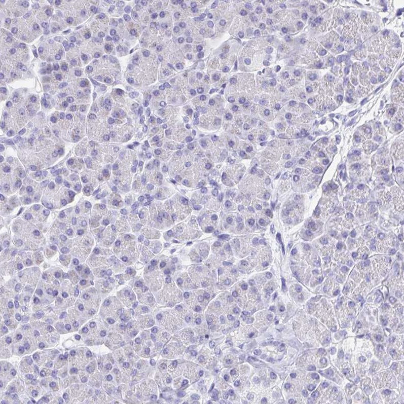 DMBT1/GP340 Antibody - BSA Free Immunohistochemistry-Paraffin: DMBT1/GP340 Antibody [NBP2-38471]