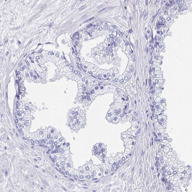 DMBT1/GP340 Antibody - BSA Free Immunohistochemistry-Paraffin: DMBT1/GP340 Antibody [NBP2-38471]