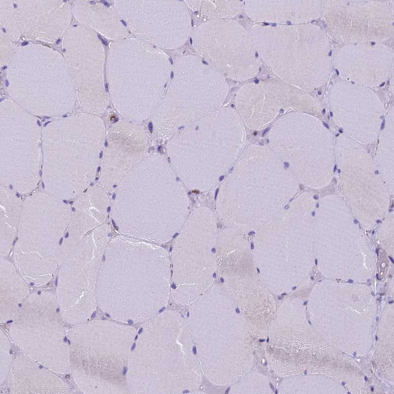 CDAN1 Antibody - BSA Free Immunohistochemistry-Paraffin: CDAN1 Antibody [NBP2-38473]