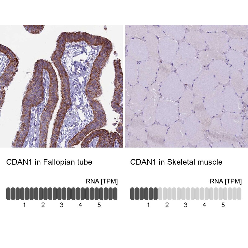 CDAN1 Antibody - BSA Free Immunohistochemistry-Paraffin: CDAN1 Antibody [NBP2-38473]