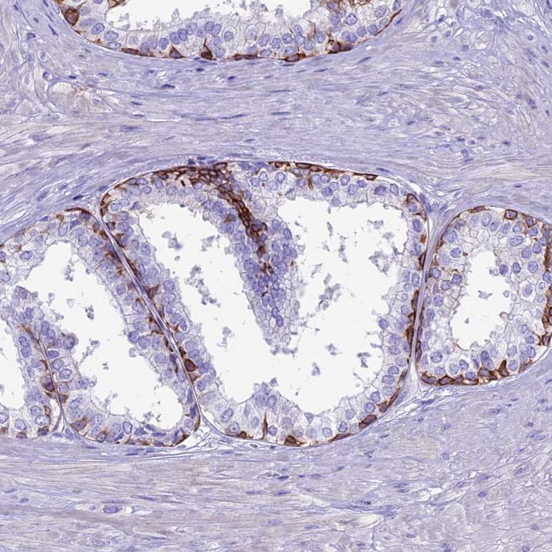 CDAN1 Antibody - BSA Free Immunohistochemistry-Paraffin: CDAN1 Antibody [NBP2-38473]
