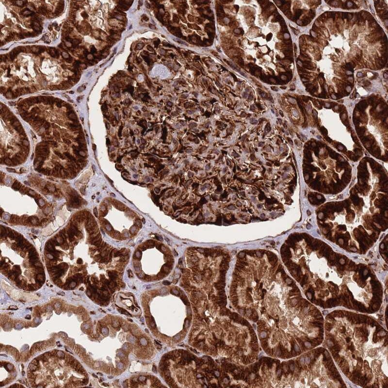 CISH/CIS-1 Antibody - BSA Free Immunohistochemistry-Paraffin: CISH/CIS-1 Antibody [NBP2-38474]