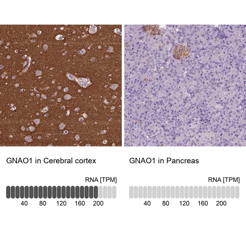 GO Protein alpha Antibody - BSA Free Immunohistochemistry-Paraffin: GO Protein alpha Antibody [NBP2-38477]