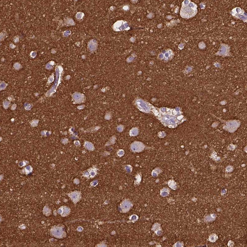 GO Protein alpha Antibody - BSA Free Immunohistochemistry-Paraffin: GO Protein alpha Antibody [NBP2-38477]