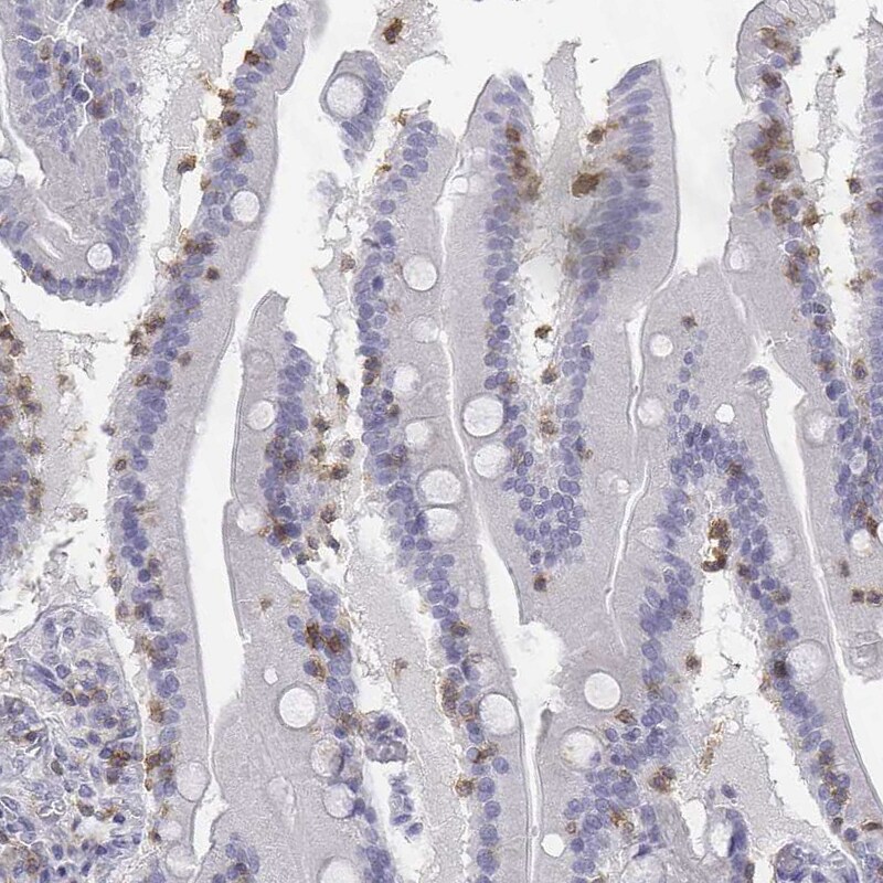 CD3 epsilon Antibody - BSA Free Immunohistochemistry-Paraffin: CD3 epsilon Antibody [NBP2-38479]
