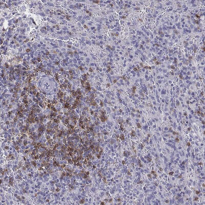 CD3 epsilon Antibody - BSA Free Immunohistochemistry-Paraffin: CD3 epsilon Antibody [NBP2-38479]
