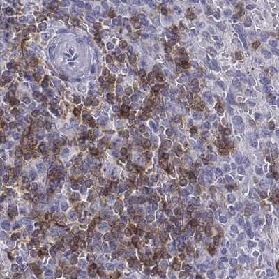 CD3 epsilon Antibody - BSA Free Immunohistochemistry-Paraffin: CD3 epsilon Antibody [NBP2-38479]