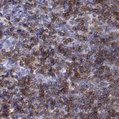 CD3 epsilon Antibody - BSA Free Immunohistochemistry-Paraffin: CD3 epsilon Antibody [NBP2-38479]