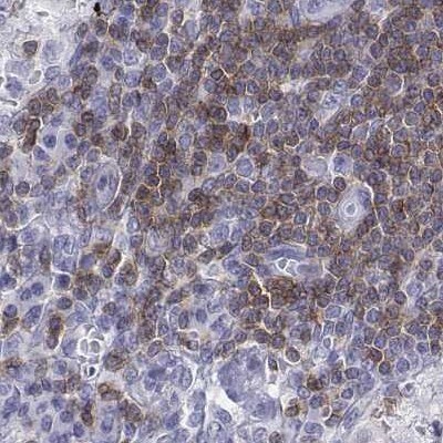 CD3 epsilon Antibody - BSA Free Immunohistochemistry-Paraffin: CD3 epsilon Antibody [NBP2-38479]