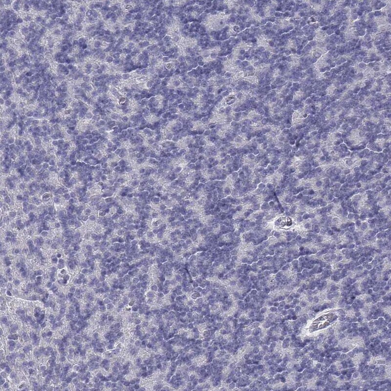 CD3 epsilon Antibody - BSA Free Immunohistochemistry-Paraffin: CD3 epsilon Antibody [NBP2-38479]