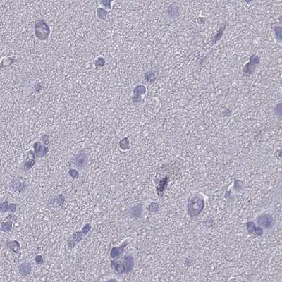 CD3 epsilon Antibody - BSA Free Immunohistochemistry-Paraffin: CD3 epsilon Antibody [NBP2-38479]