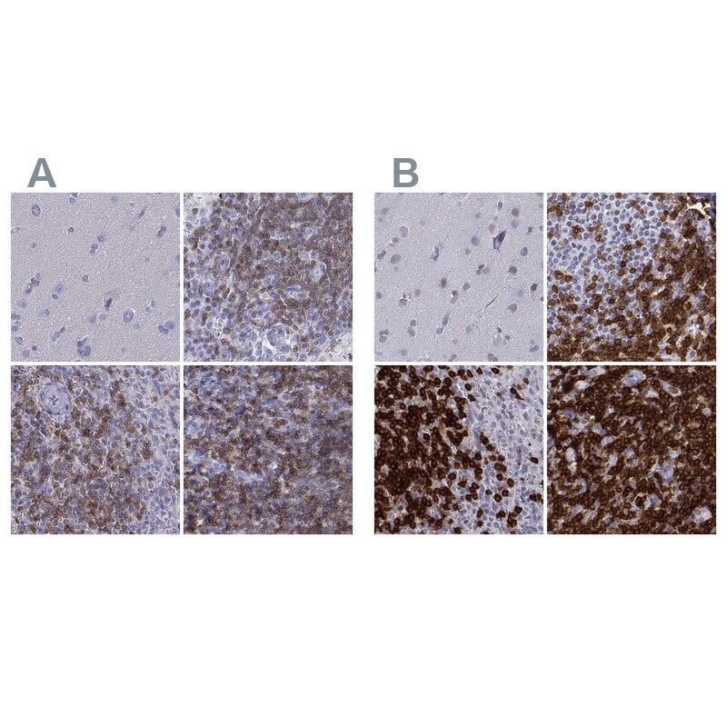 CD3 epsilon Antibody - BSA Free Immunohistochemistry-Paraffin: CD3 epsilon Antibody [NBP2-38479]