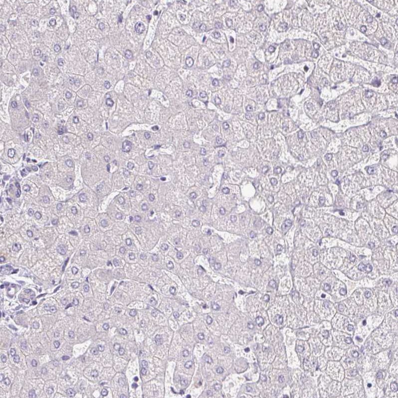 IL-18 BPa/IL18BP Antibody - BSA Free Immunohistochemistry-Paraffin: IL-18 BPa/IL18BP Antibody [NBP2-38481] -