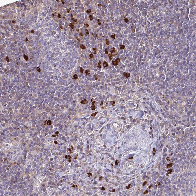 IL-18 BPa/IL18BP Antibody - BSA Free Immunohistochemistry-Paraffin: IL-18 BPa/IL18BP Antibody [NBP2-38481] -