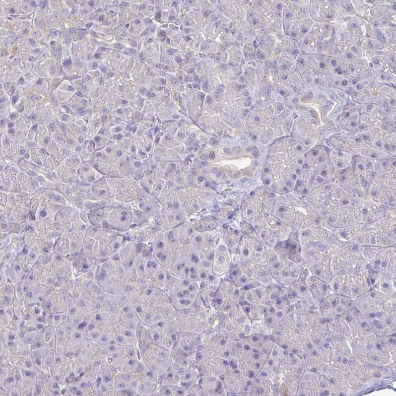 IL-18 BPa/IL18BP Antibody - BSA Free Immunohistochemistry-Paraffin: IL-18 BPa/IL18BP Antibody [NBP2-38481] -