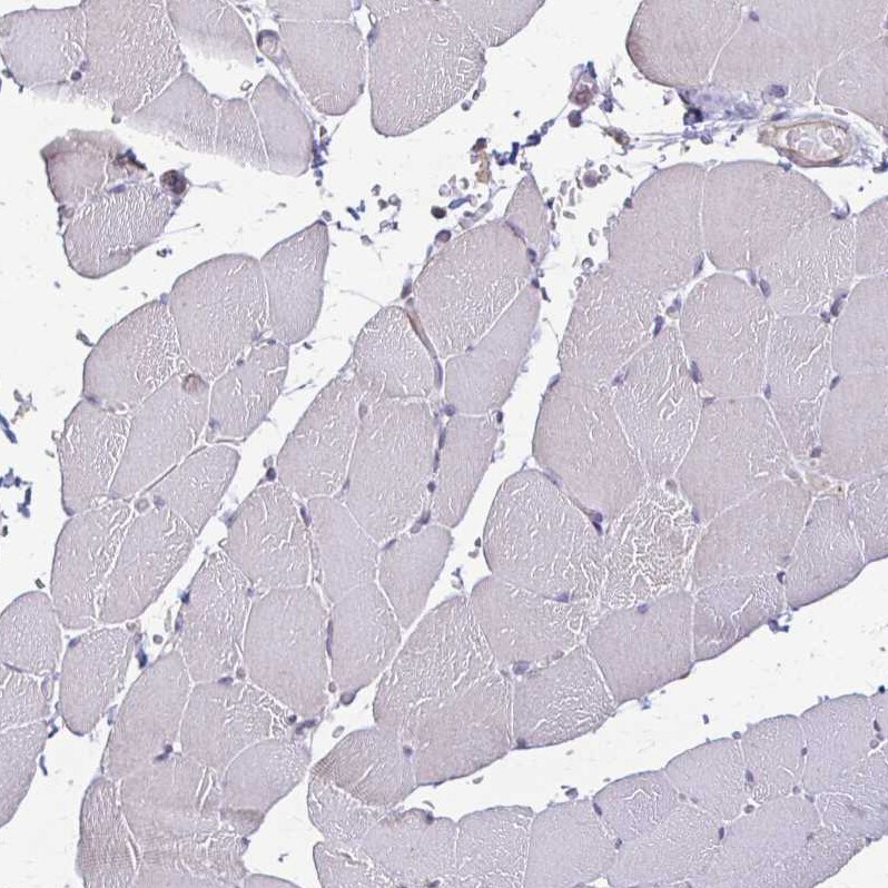 IL-18 BPa/IL18BP Antibody - BSA Free Immunohistochemistry-Paraffin: IL-18 BPa/IL18BP Antibody [NBP2-38481] -