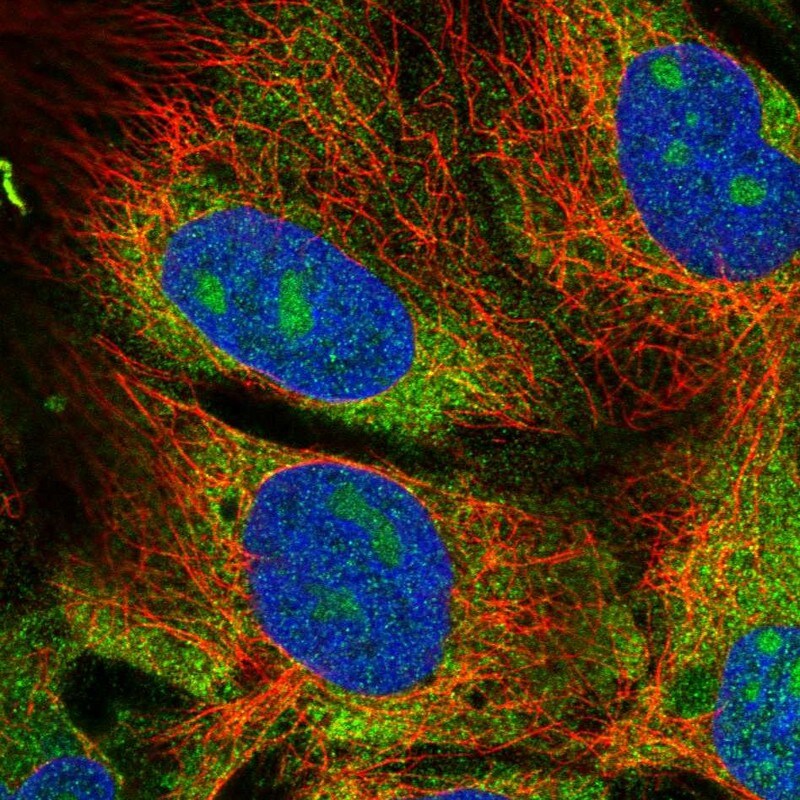 EIF2 beta Antibody - BSA Free Immunocytochemistry/ Immunofluorescence: EIF2 beta Antibody [NBP2-38483]