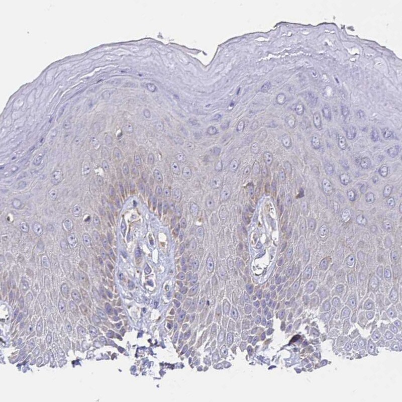 Peroxiredoxin 3 Antibody - BSA Free Immunohistochemistry-Paraffin: Peroxiredoxin 3 Antibody [NBP2-38486]