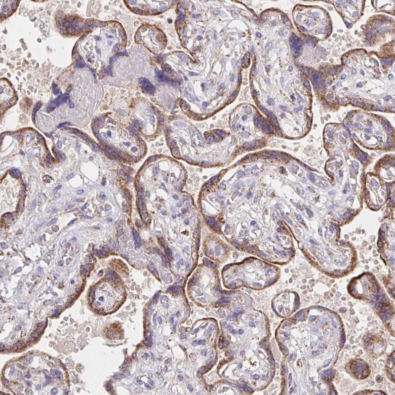 Peroxiredoxin 3 Antibody - BSA Free Immunohistochemistry-Paraffin: Peroxiredoxin 3 Antibody [NBP2-38486]
