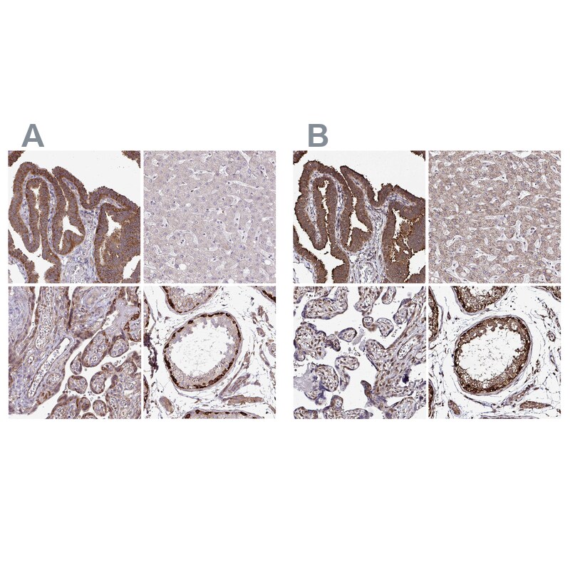 FMRP Antibody Immunohistochemistry-Paraffin: FMRP Antibody Antibody [NBP2-38617]