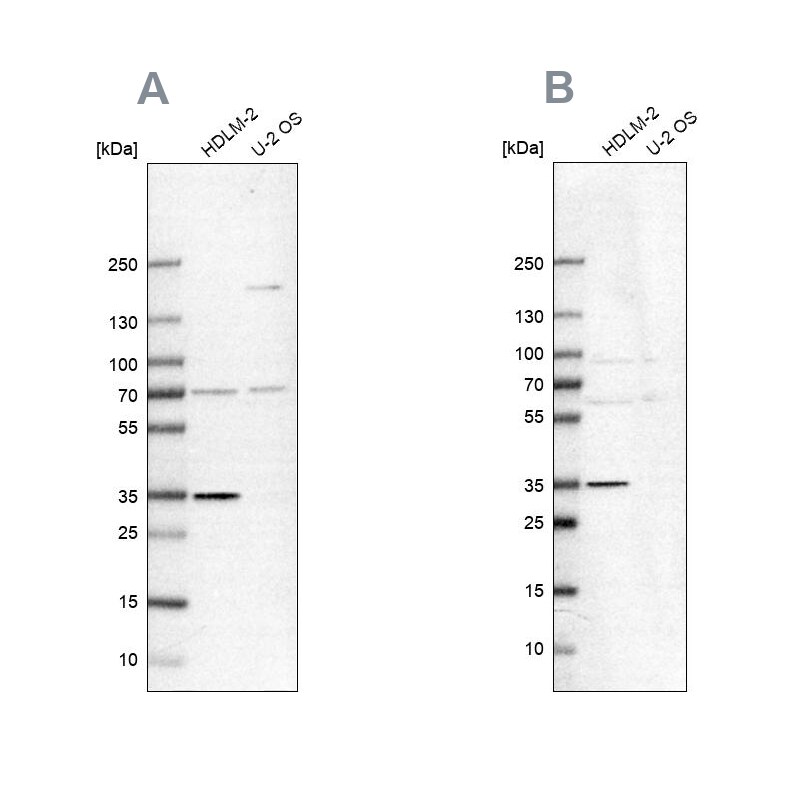 TTC19 Antibody Western Blot: TTC19 Antibody Antibody [NBP2-38667]
