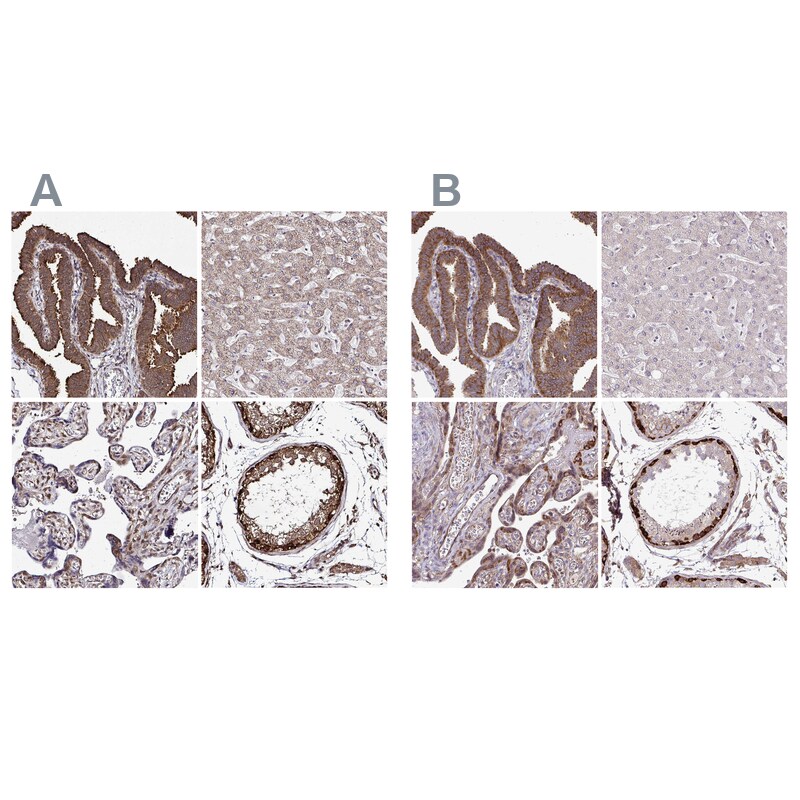 FMRP Antibody Immunohistochemistry-Paraffin: FMRP Antibody Antibody [NBP2-38783]