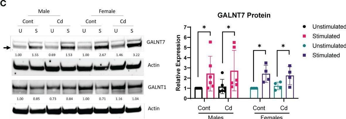 Polypeptide GalNac Transferase 7/GALNT7 Antibody - BSA Free