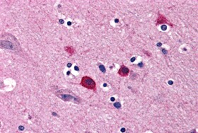 BOK Antibody - BSA Free