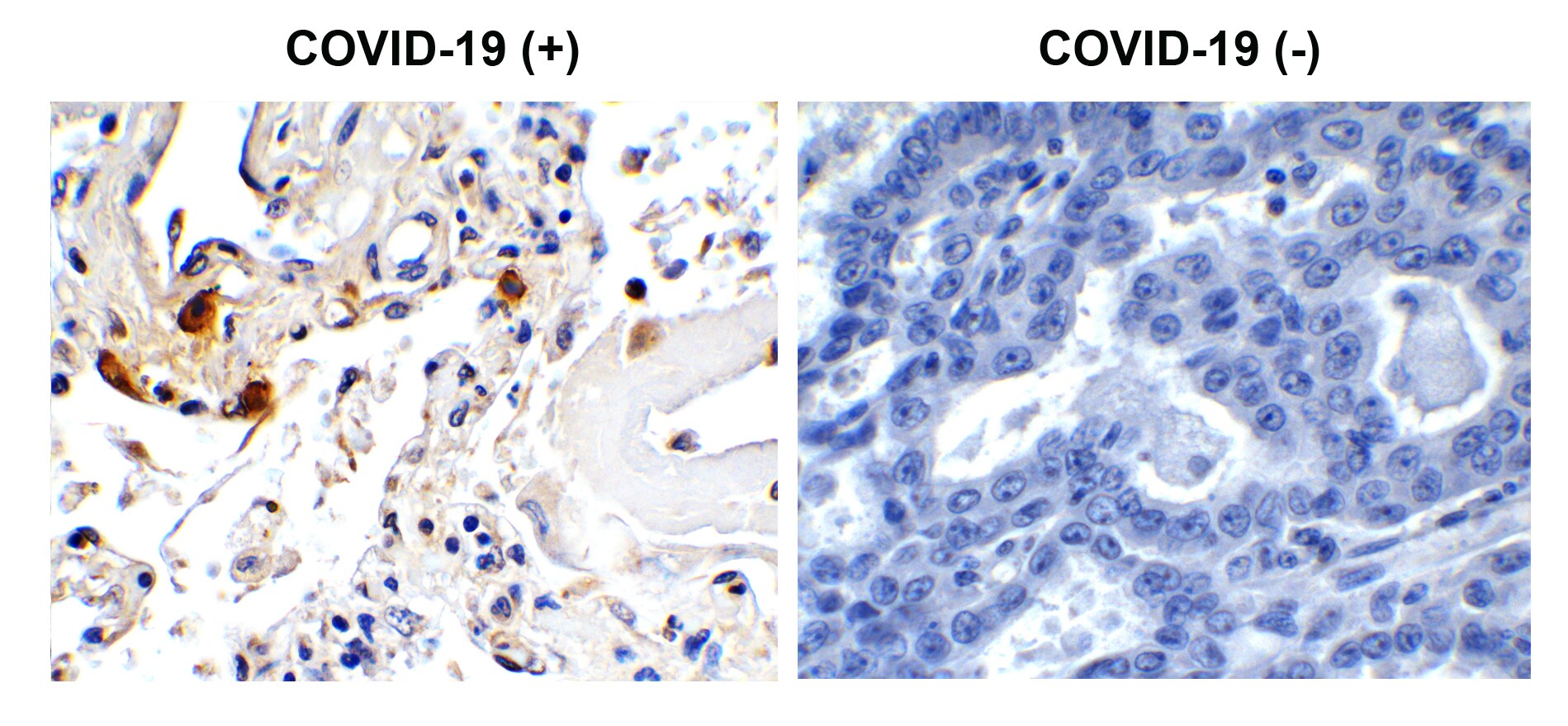SARS-CoV-2 Envelope Antibody - BSA Free
