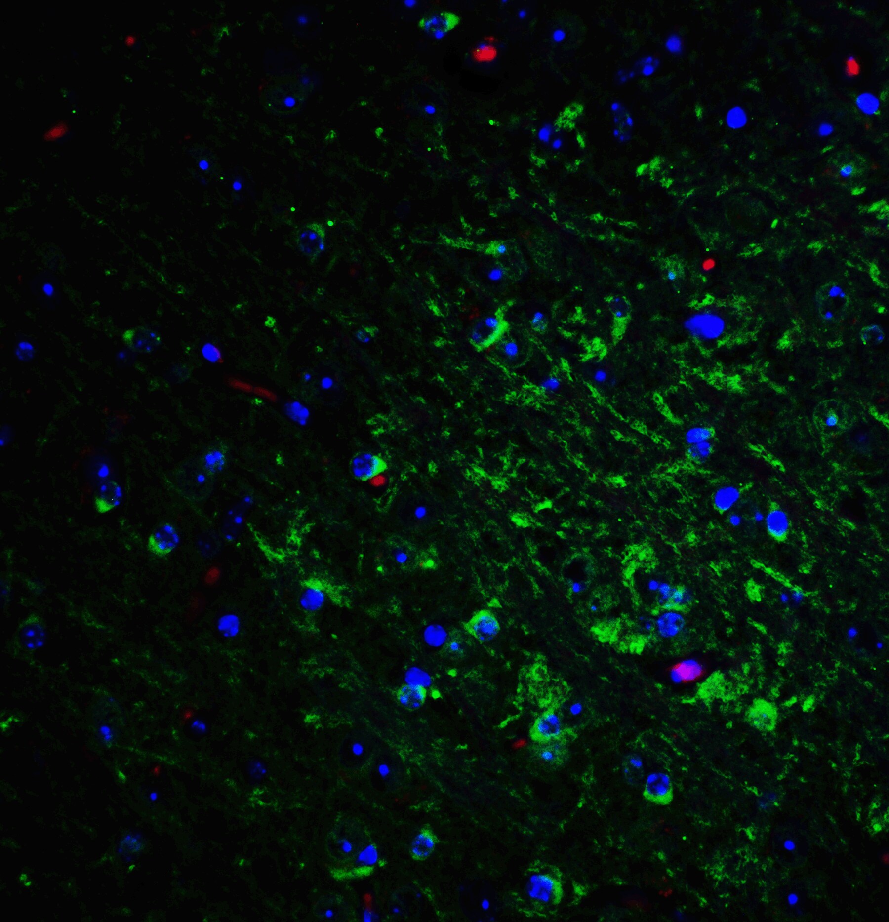 Nogo-A Antibody - BSA Free
