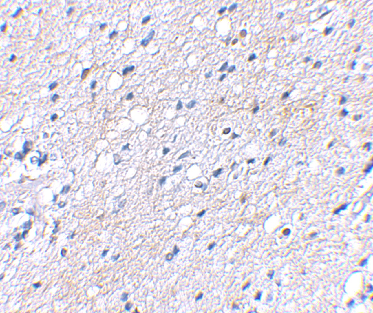 BAIAP3 Antibody - BSA Free