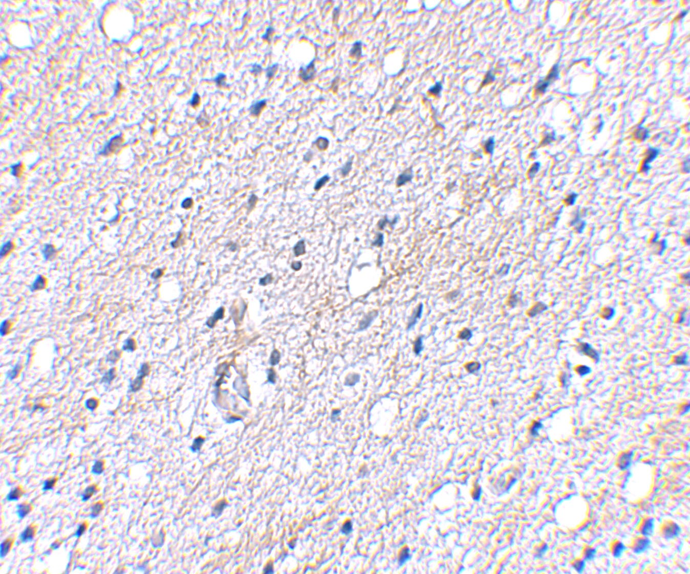 BAIAP3 Antibody - BSA Free